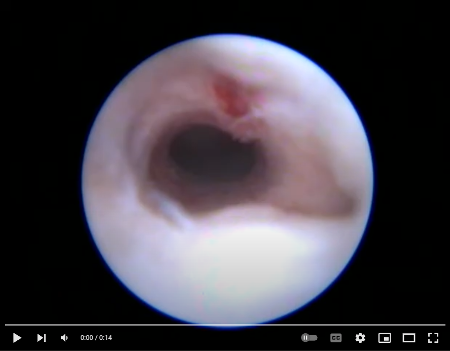 Co znamená slovo polyp?